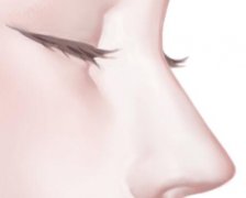 张汀琼整形医生怎么样？医生经验丰富，技术精湛
